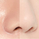 a woman's nose before and after a nose lift