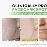 Jumiso - All Day Vitamin Pure C 5.5 Glow Serum demonstrating visible results: before and after images showing skin tone improvement in just 14 days.