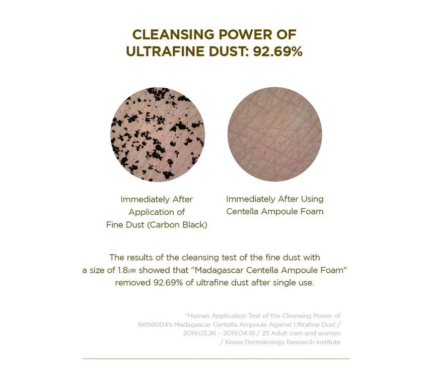 Application of Skin1004 Madagascar Centella Ampoule Foam 20ml on skin, demonstrating its soothing properties and the power of Centella Asiatica foam for a balanced cleanse.