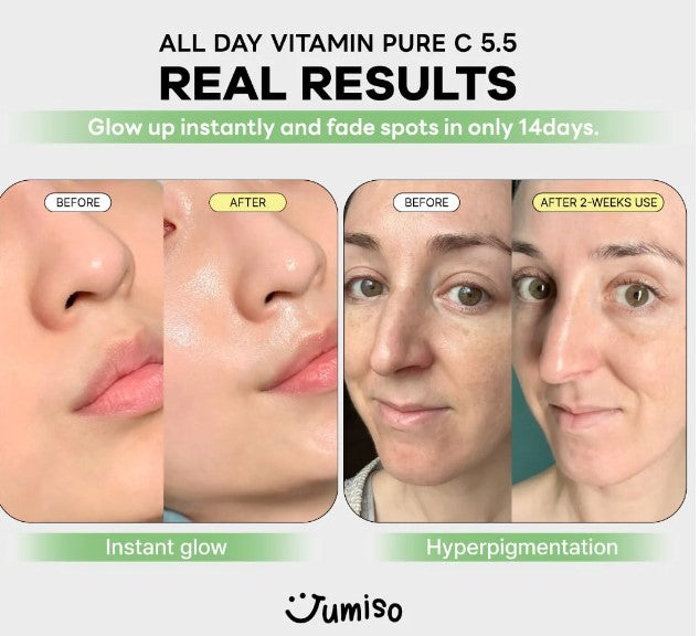 Jumiso - All Day Vitamin Pure C 5.5 Glow Serum showcasing real user results with side-by-side before and after photos displaying instant glow and reduction in hyperpigmentation.